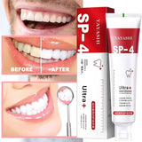 Ultra Whitening Toothpaste Probiotic Stain Remover